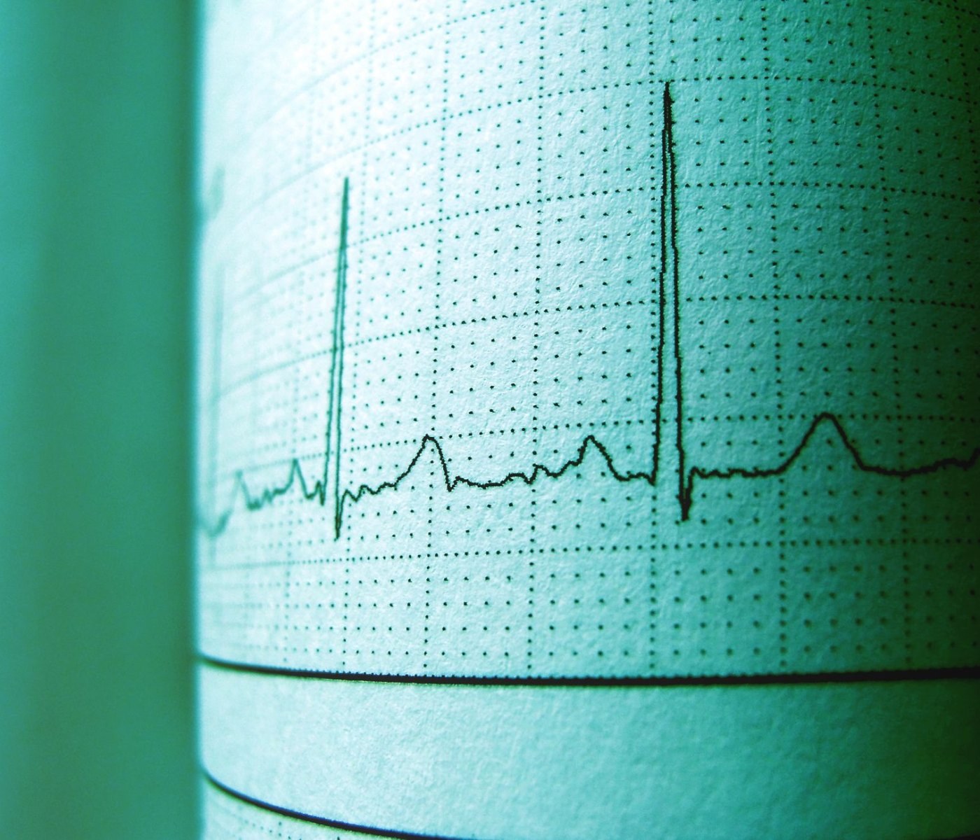 Core Web Vitals Optimierung: Ladezeit um 62% verbessert 1 Core Web Vitals Optimierung: Ladezeit um 62% verbessert